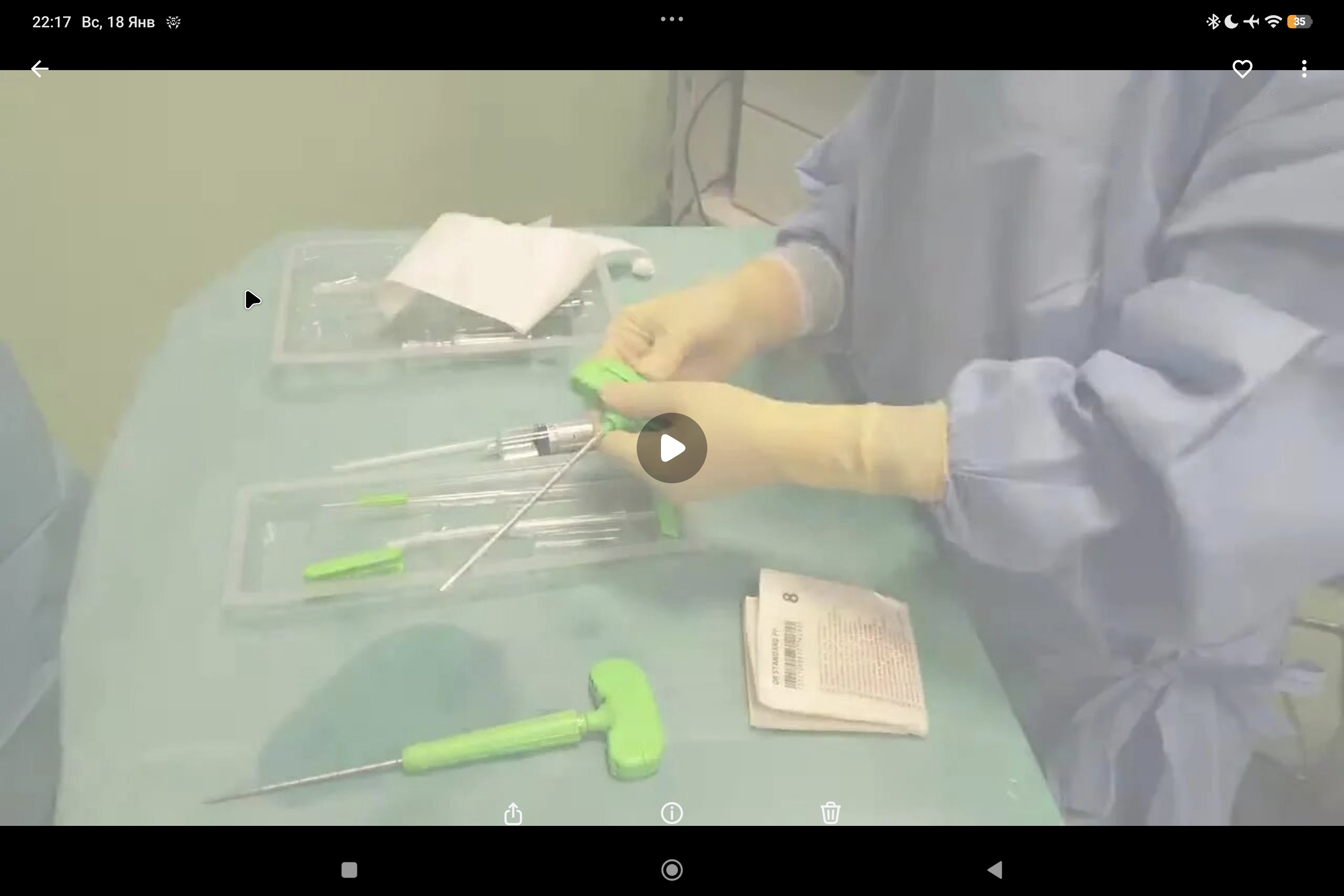 Marrow-Stem: применение МСК костного мозга при остеотомии голеностопного сустава