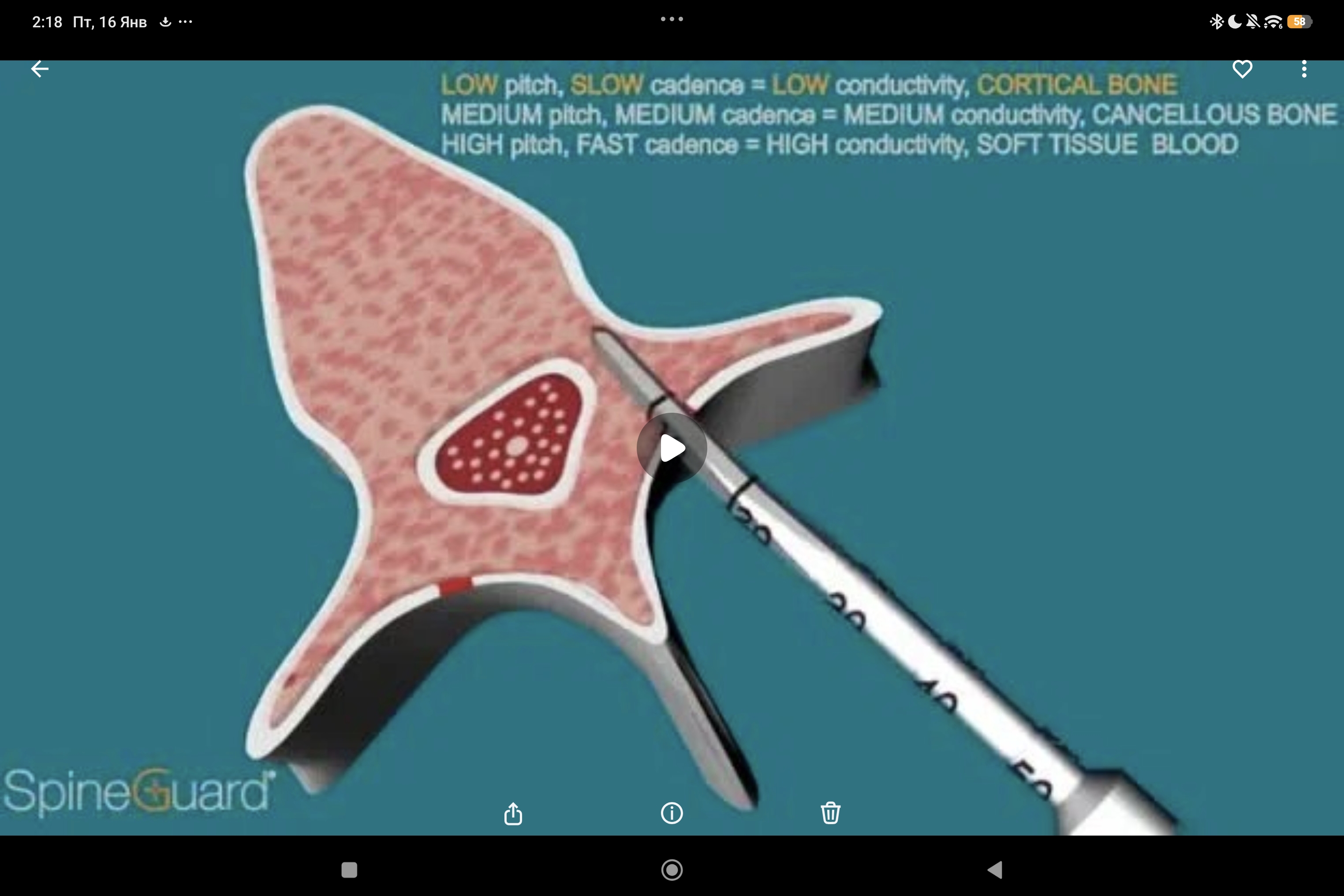 изогнутый Curved PediGuard