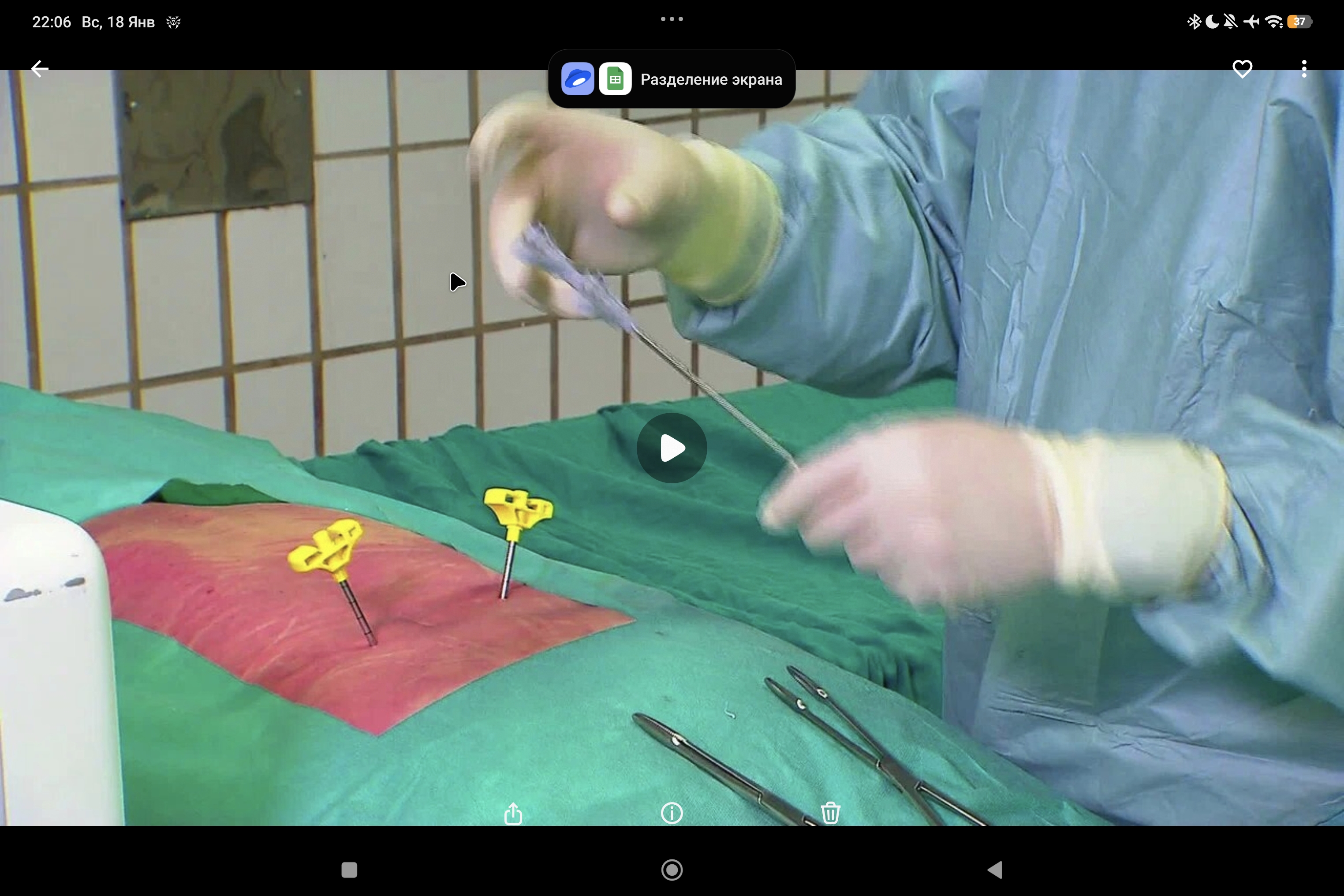 Joline 12: нанесение цемента