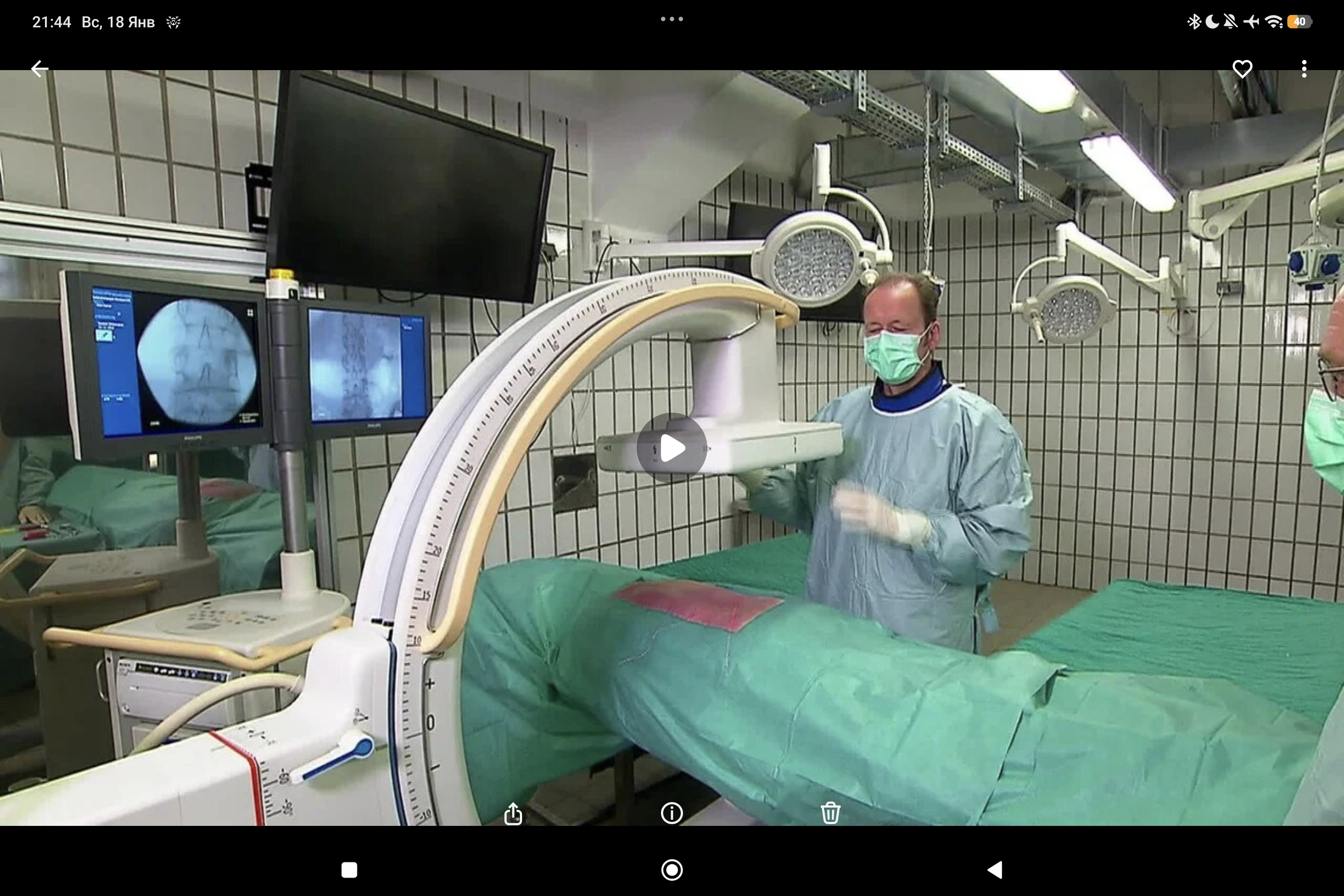 Joline 06: направление точки входа на уровне кожи