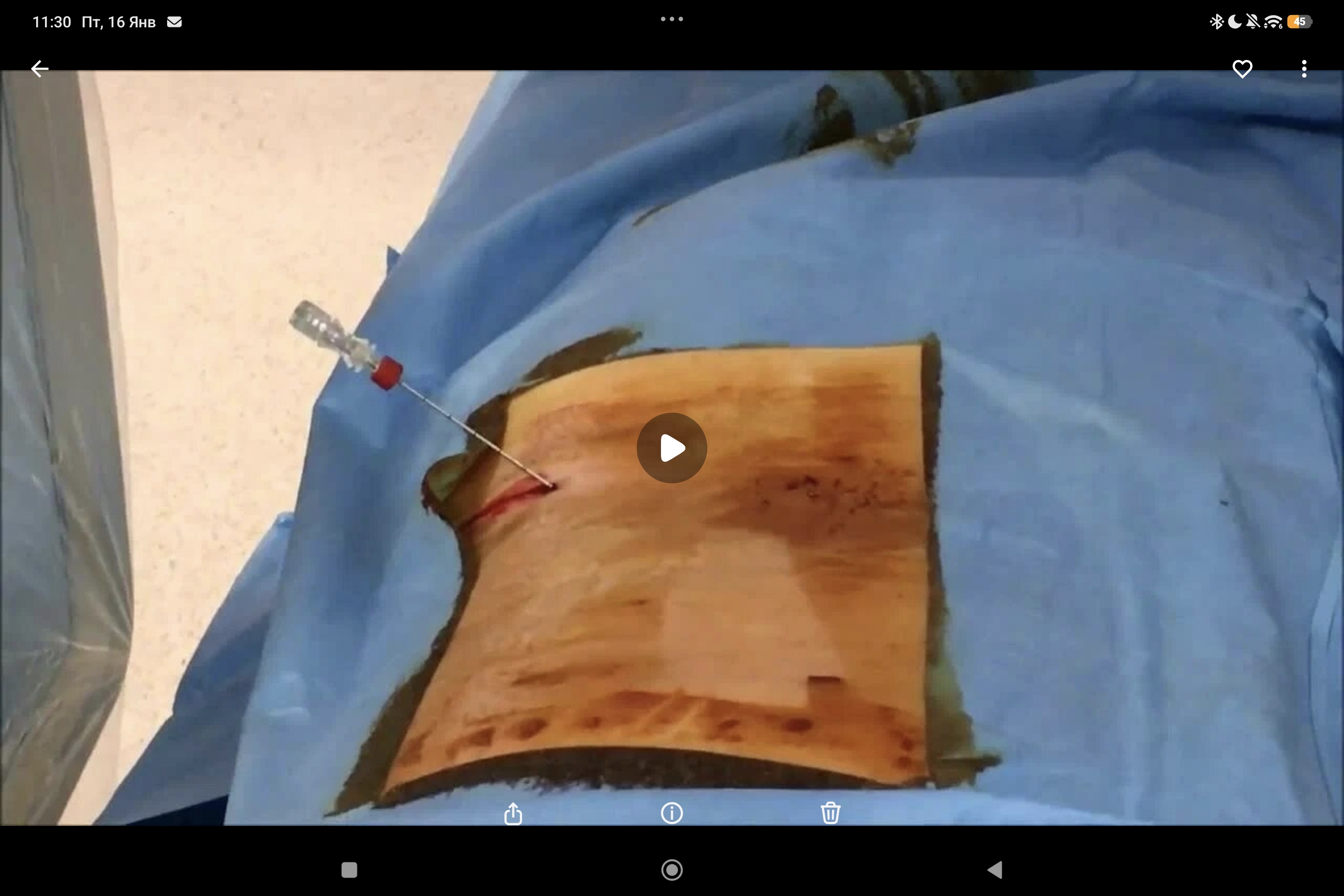 процедура DISKOM