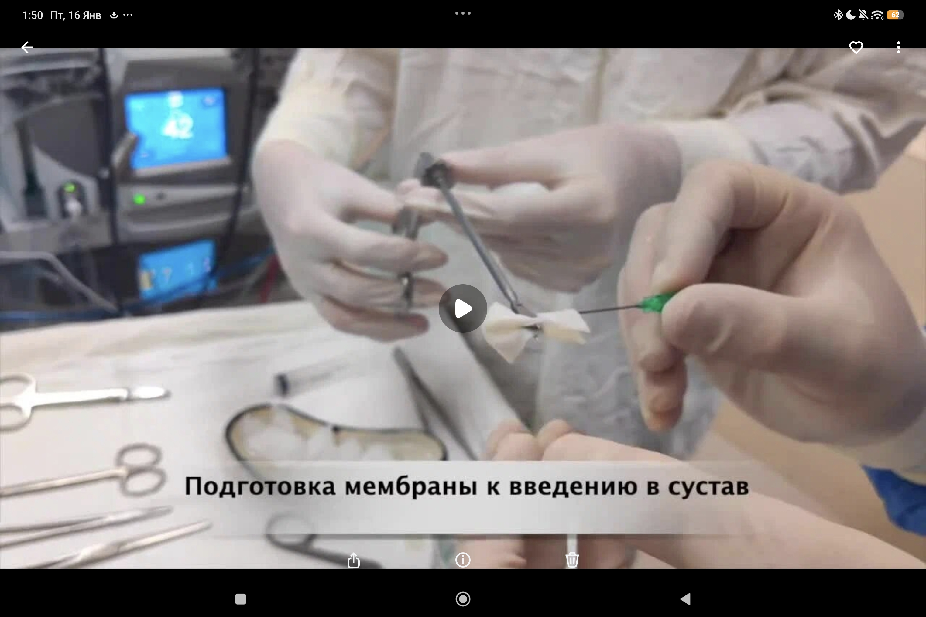 артроскопическая пластика мениска по методике AMICplus с мембраной Chondro-Gide