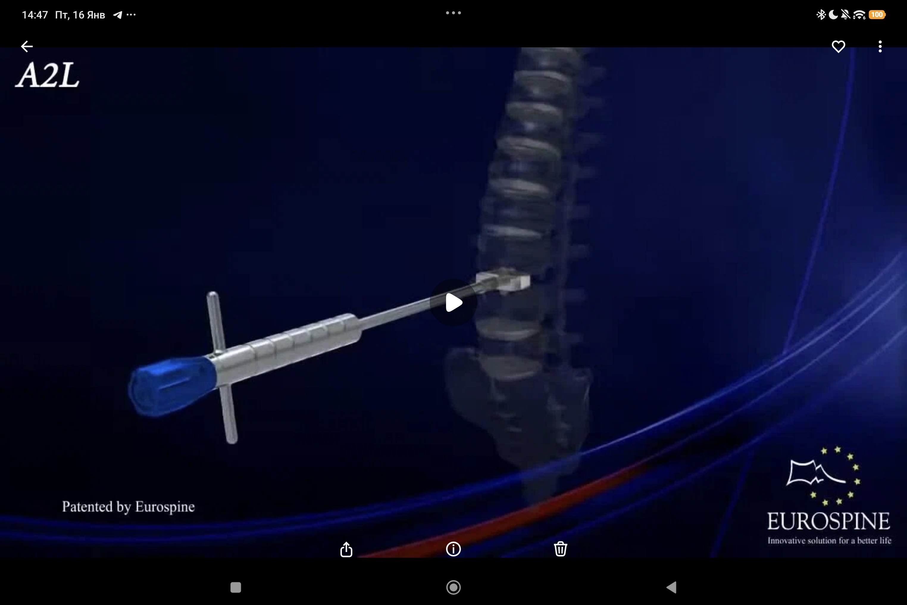 HRC ALIF: стабилизирующий поясничный кейдж для передней установки с двумя фиксирующими лезвиями