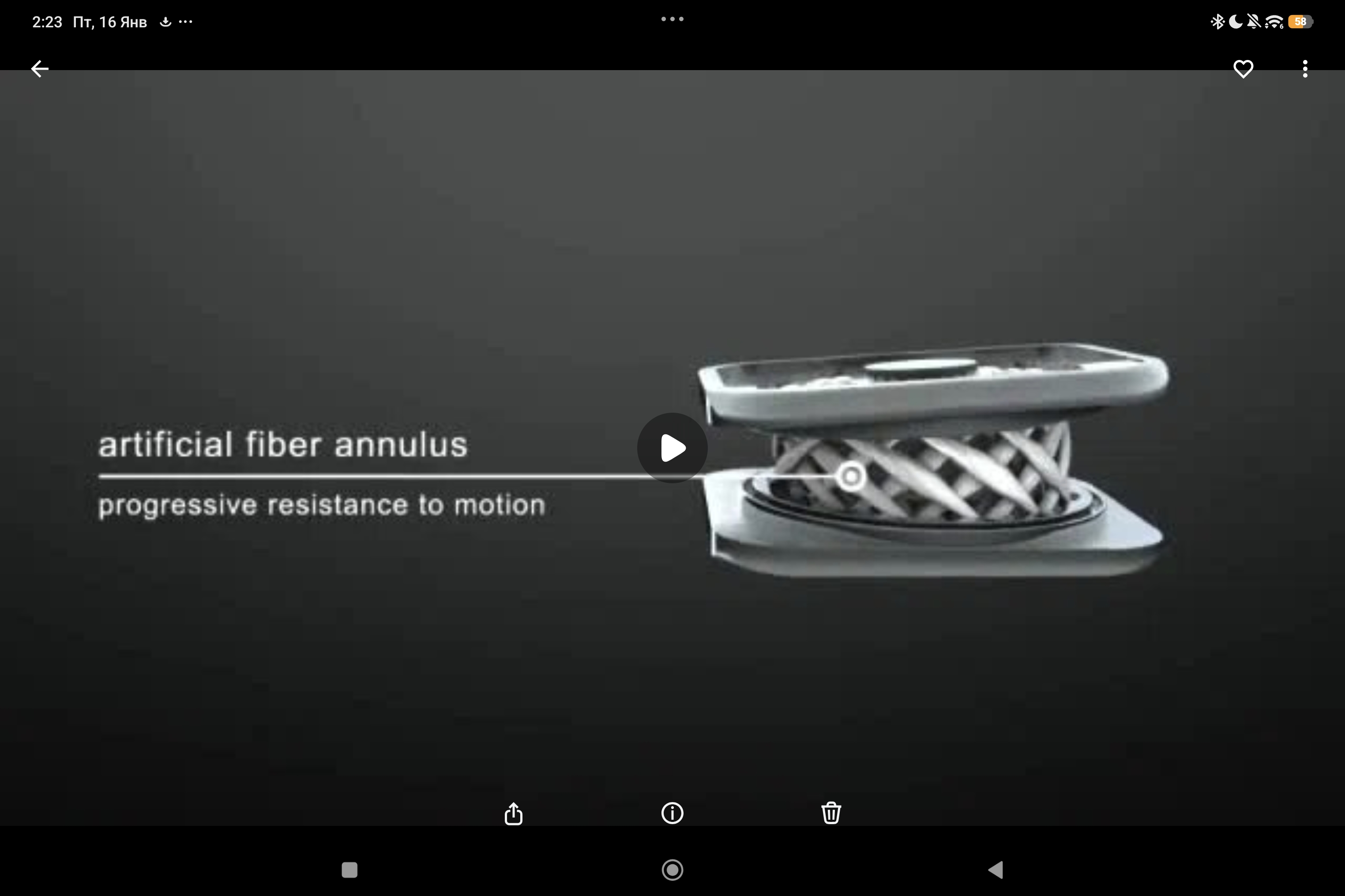 конструкция эндопротеза межпозвонкового шейного диска M6-C