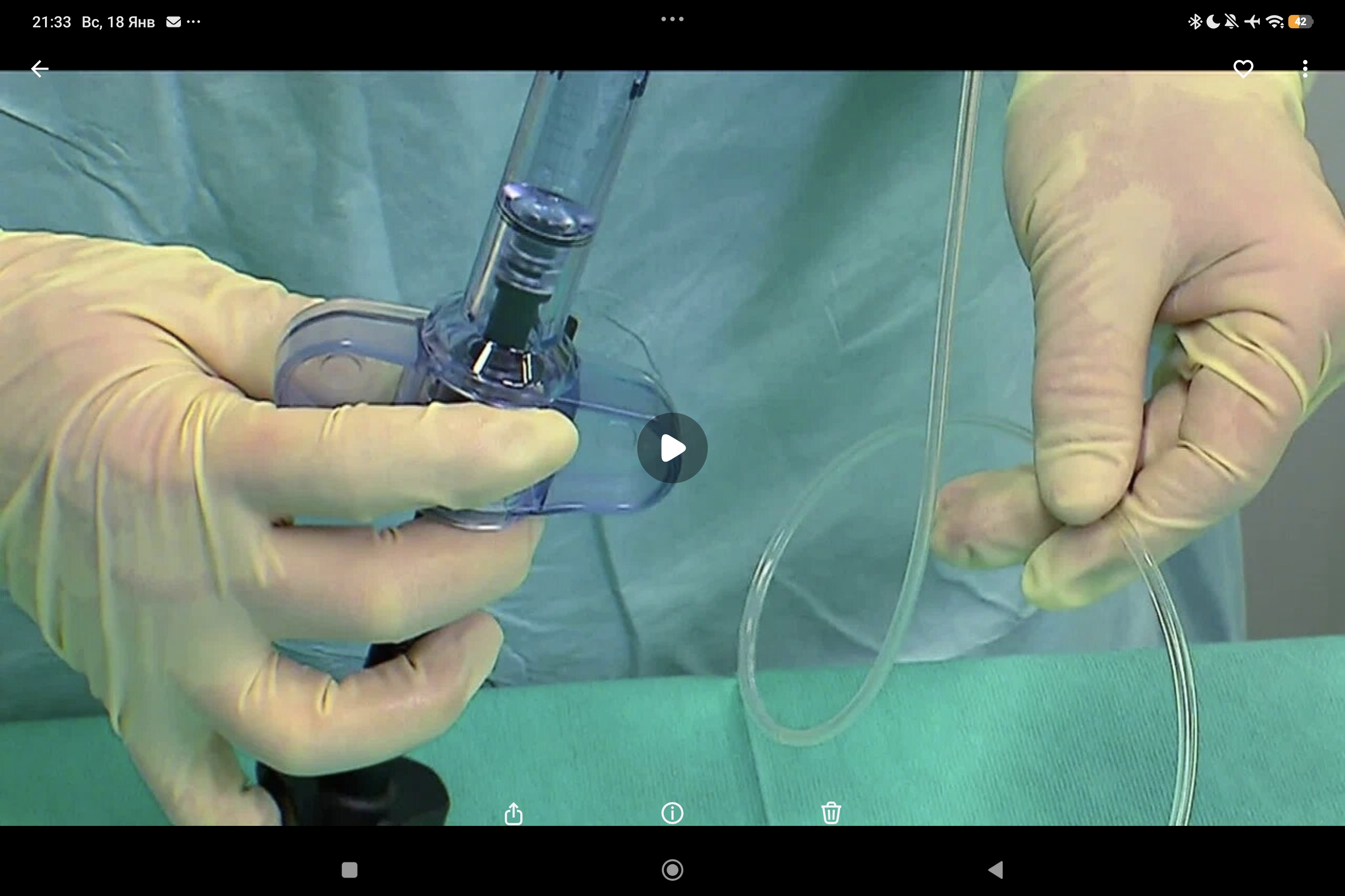 Joline 03: подготовка Quattroplasty Stop-N-Go, двойные баллонные катетеры