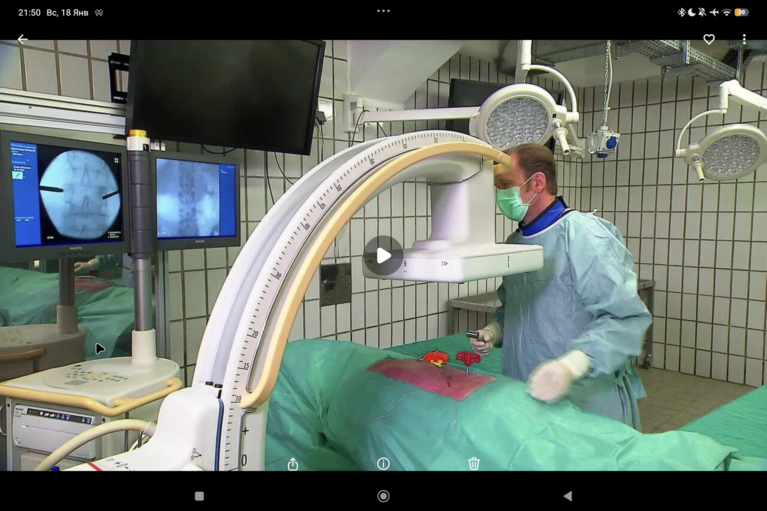 Joline 07: доступ троакаром в три шага