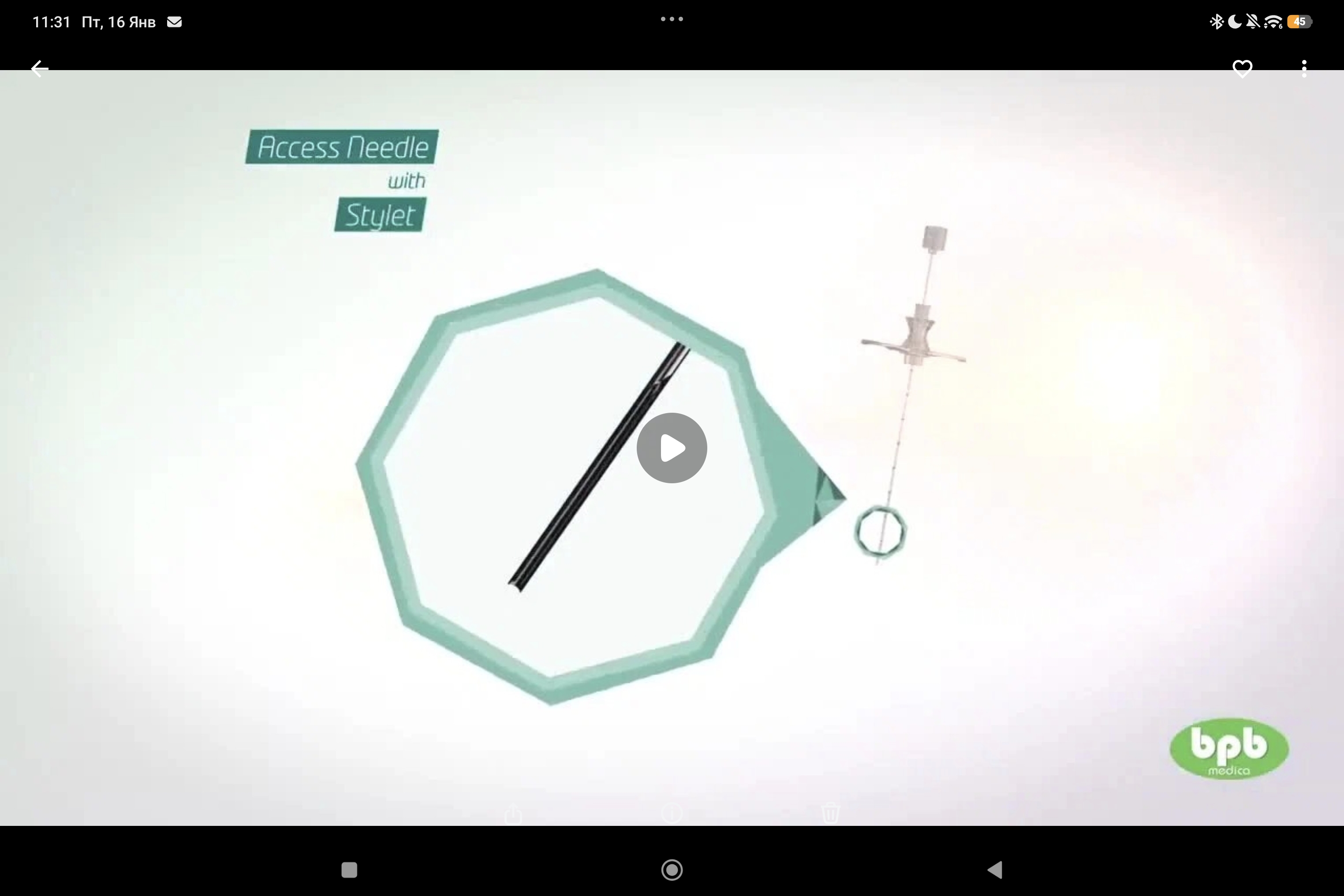 DISKOM: инструмент для перкутанной механической дискэктомии компании BiopsyBell