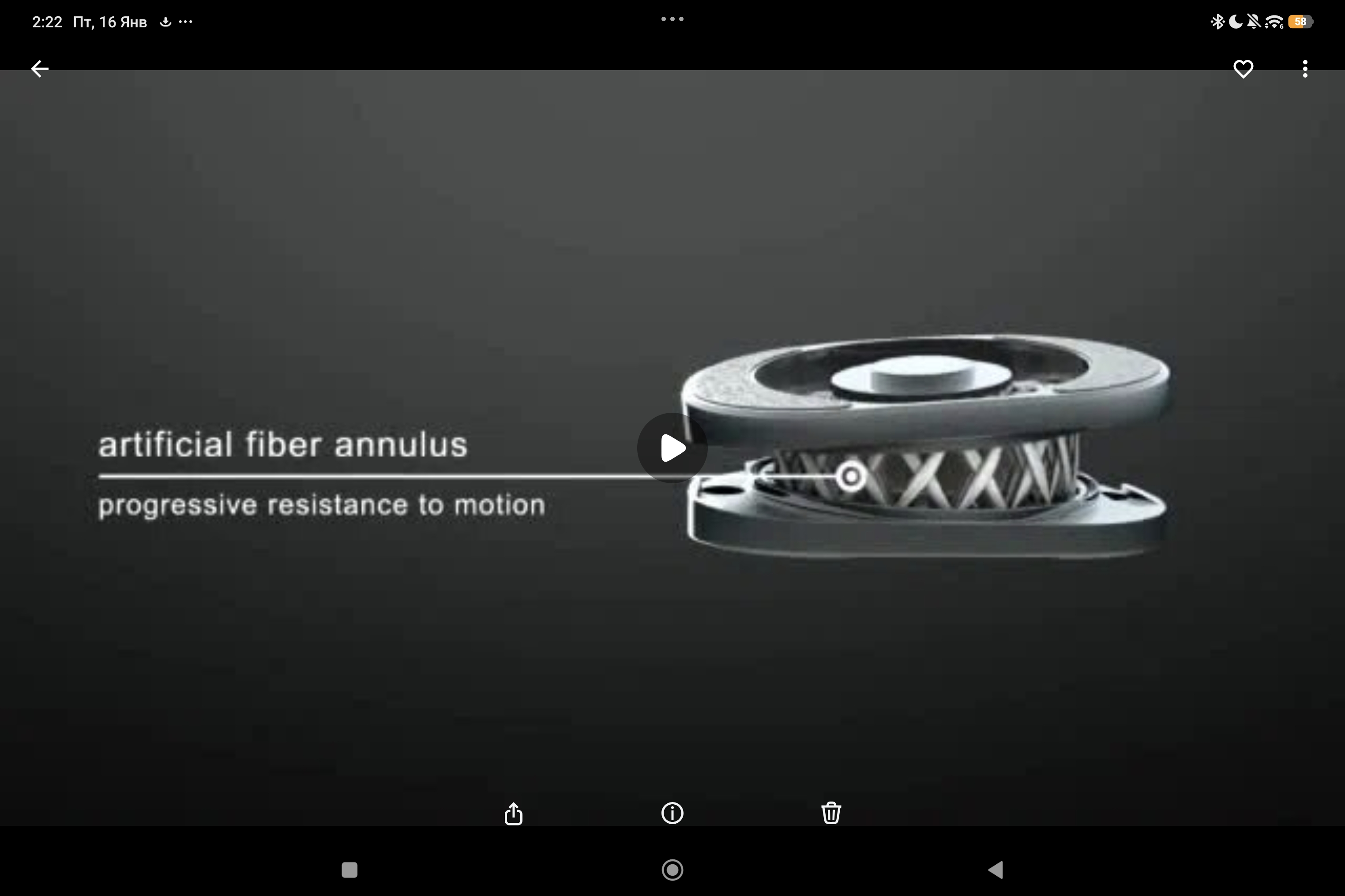 конструкция эндопротеза межпозвонкового диска M6-L