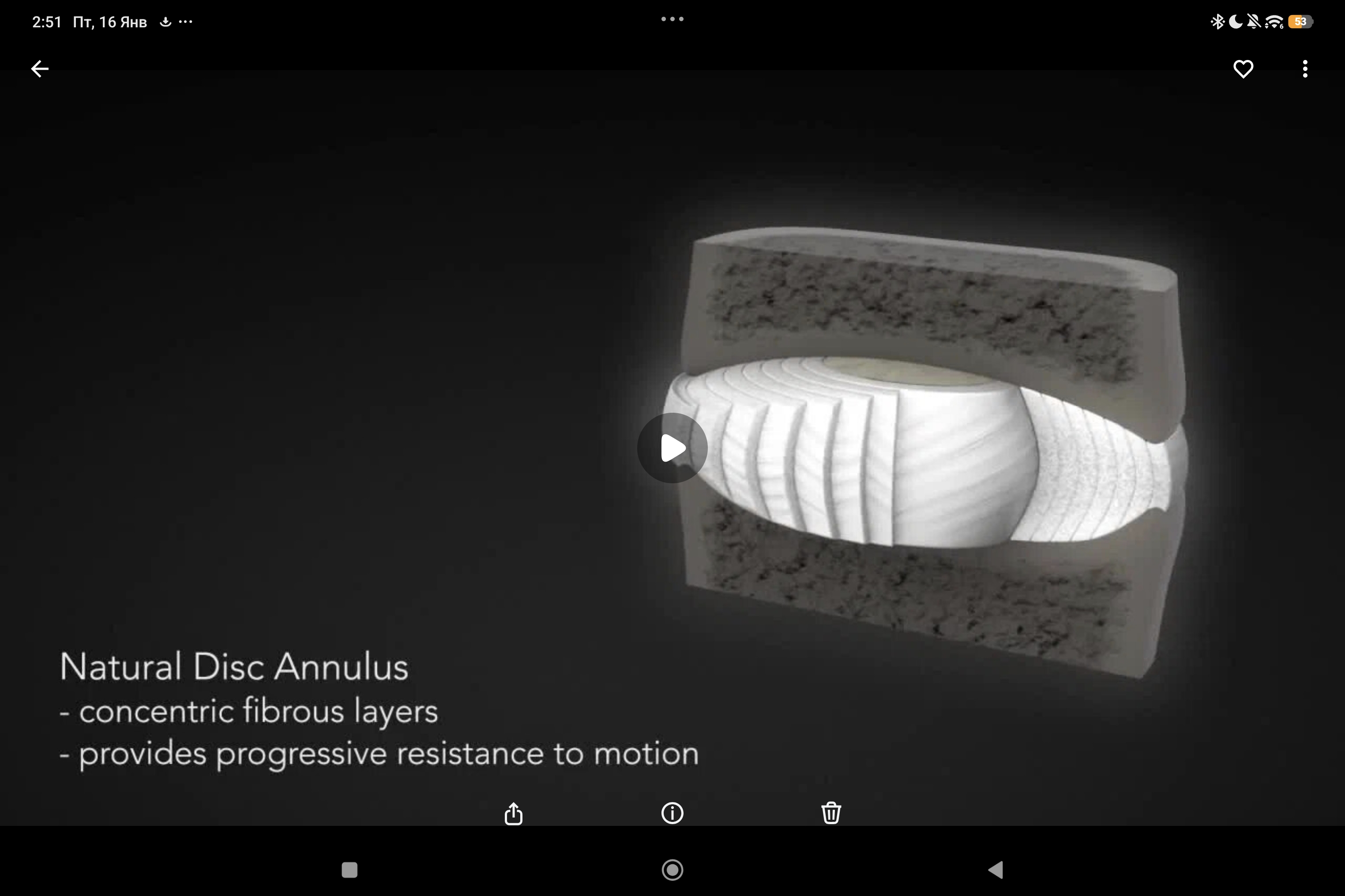 сравнение человеческого диска и эндопротеза диска M6