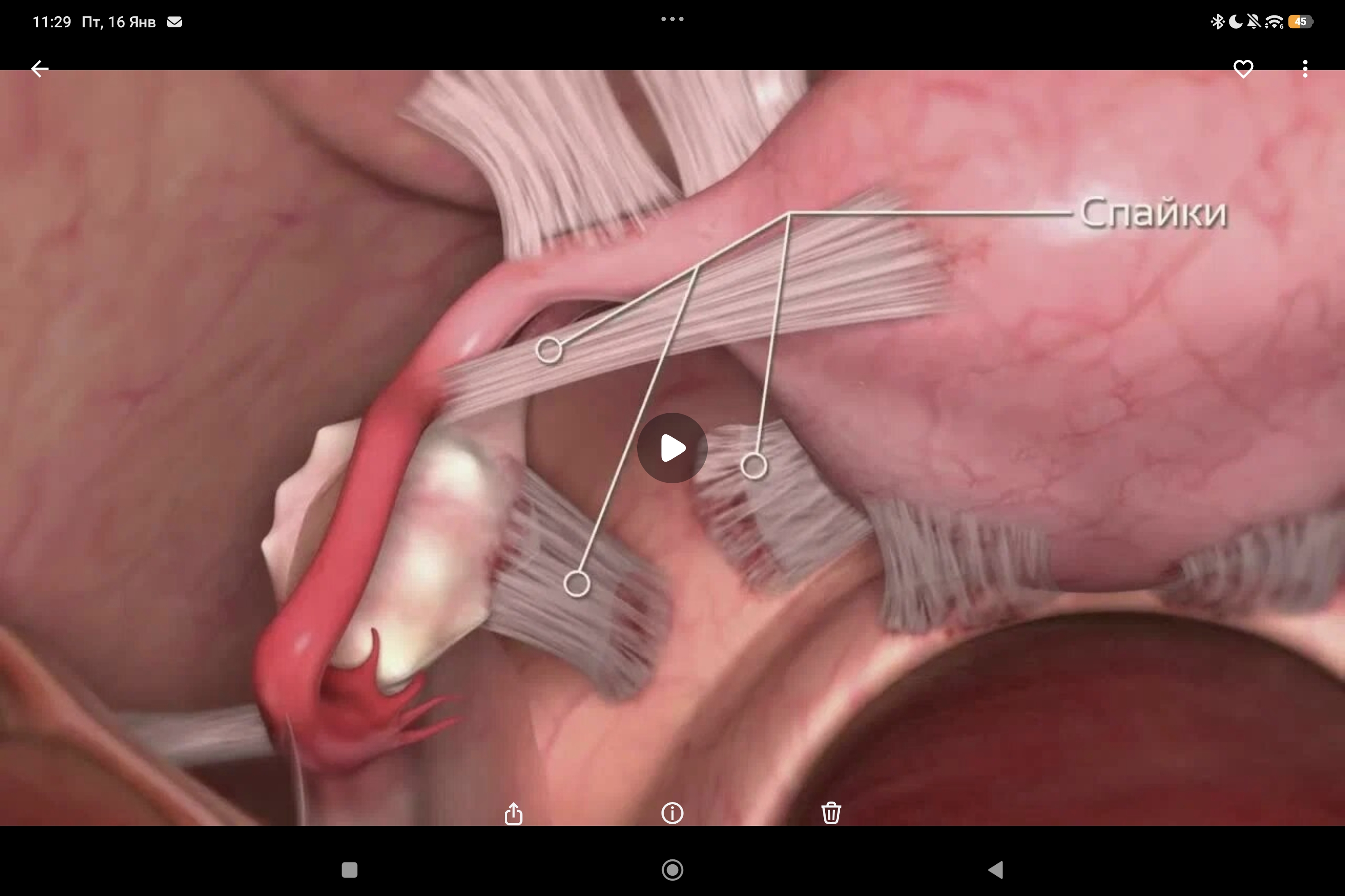 AP Intercoat Gel против спаек