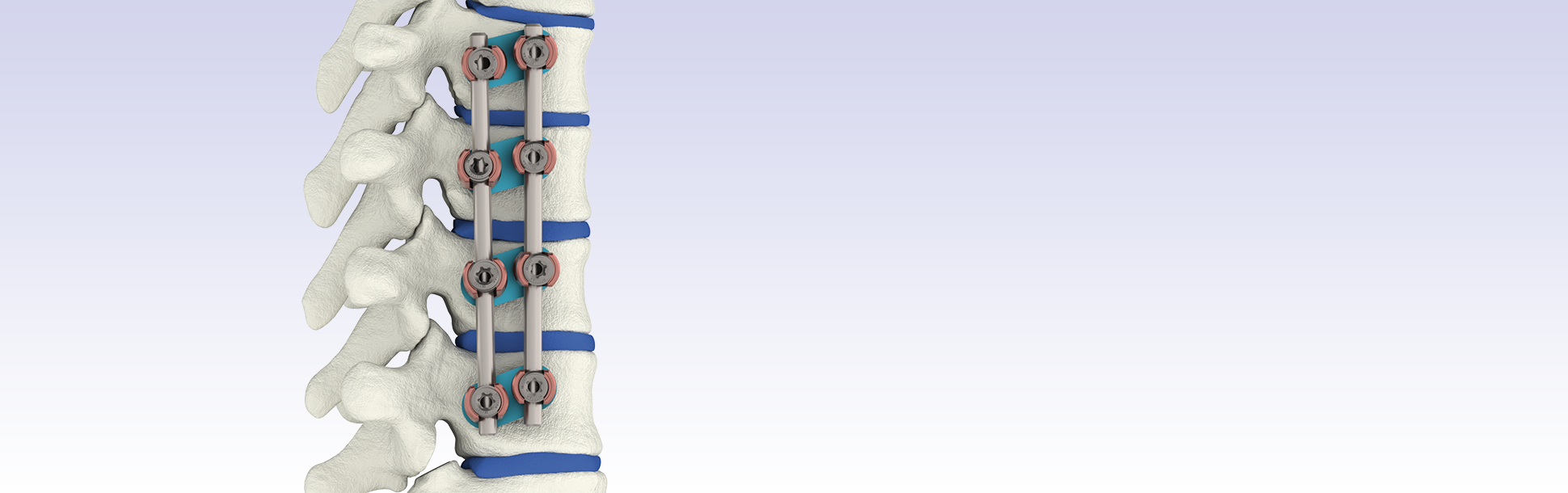 Система VENUSnano VDS.png