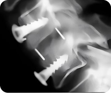 Через 12 месяцев