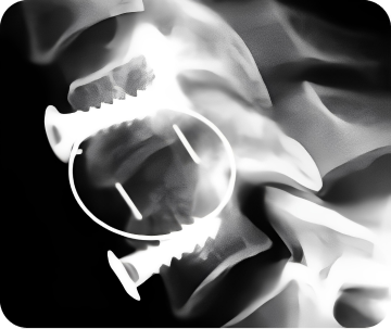 После операции