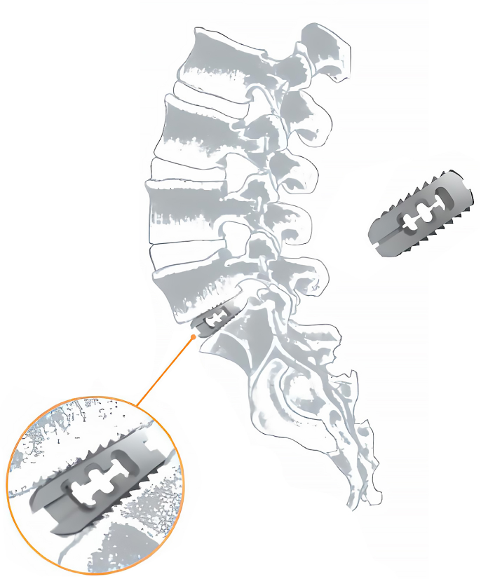 Преимущества