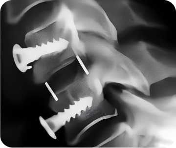 Через 6 месяцев